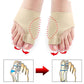 Correcteur d'oignon Coussin en Gel - 1 PAIRE